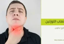 علاج التهاب اللوزتين بالأعشاب في المنزل