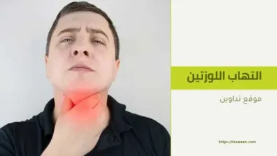 علاج التهاب اللوزتين بالأعشاب في المنزل