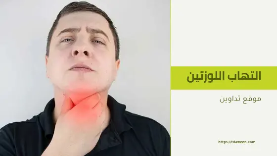علاج التهاب اللوزتين بالأعشاب في المنزل